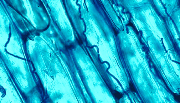 Module 6 — The Fungi Within Plants